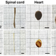 Images: Nature Mouse organs uncleared (top) and cleared (bottom)